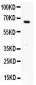 Anti-Estrogen Receptor Picoband Antibody